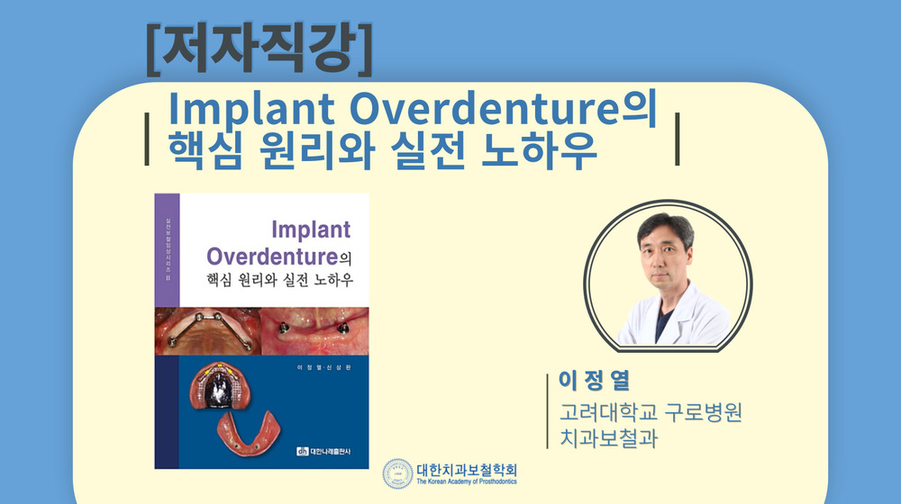 [저자직강] Implant Overdenture의 핵심원리와 실전노하우-이정열 이미지